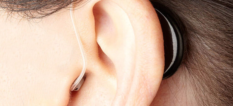 4 Best Assistive Listening Devices for the Deaf 4 Best Assistive Listening Devices for the Deaf